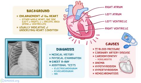 cardiomegaly is most similar to cardiac blank|mild cardiomegaly.